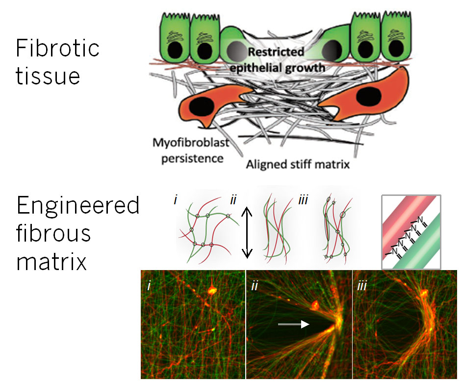 figure of Fibrous Networks in Liver Fibrosis